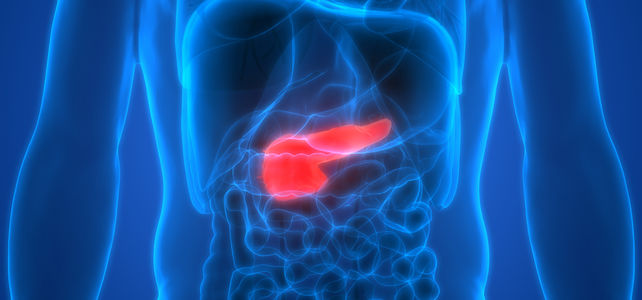 Bauchspeicheldrüsenkrebs: Fokussierter Ultraschall verkleinert Tumoren